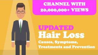 Hair Loss – Causes, Symptoms, Treatments and Prevention