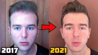 My Current Hair Loss Prevention Protocol