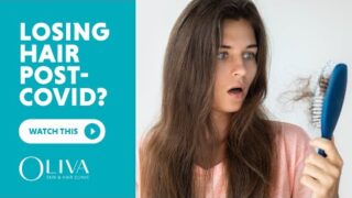 Post Covid Hair Loss | Hair Loss After Covid 19 Recovery | Tips And Tricks