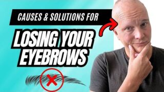 TOP Reasons for Eyebrow Hair Loss (How I Lost Mine & THE FIX) | My Two Brows