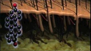 What Causes Hair Loss?